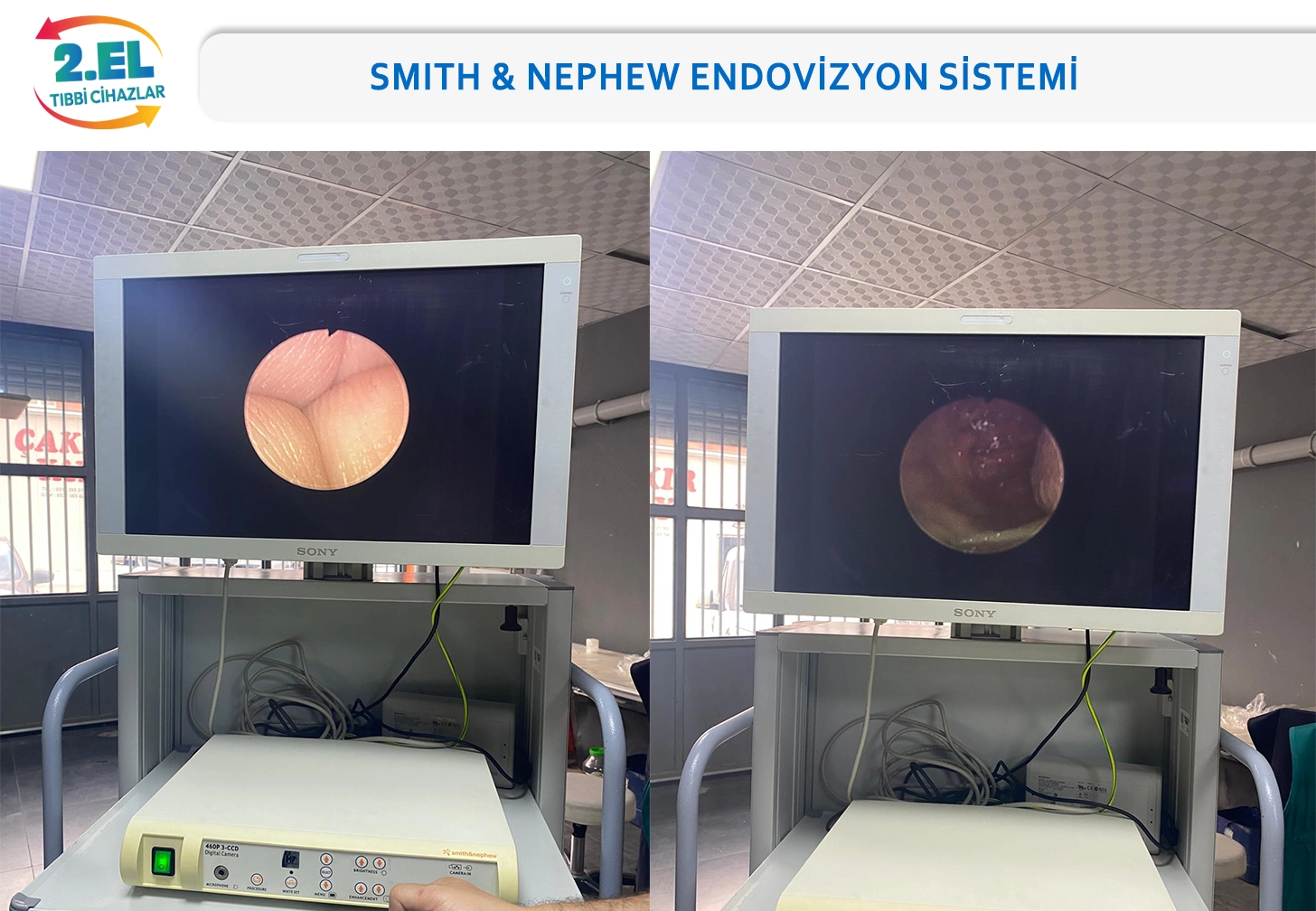2.El Smith & Nephew Endovizyon Kule